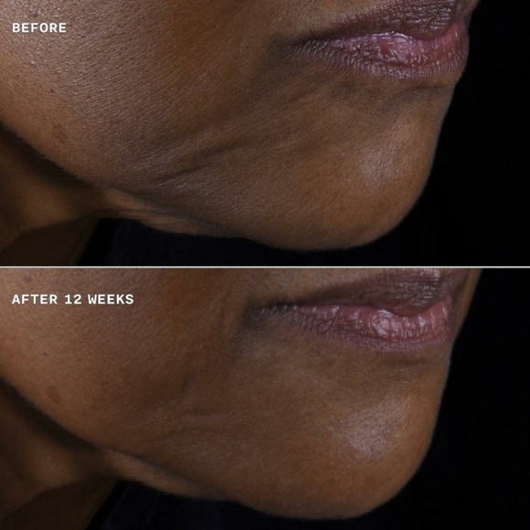 CLINIQUE SMART CLINICAL REPAIR LIFTING FACE + NECK CREAM. - Picture 3 of 12
